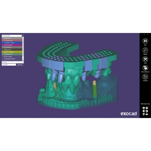 Exocad Model Creator - модуль для создания моделей | Exocad (Германия)