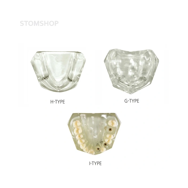 CRYSTAL IMPLANT MODEL - модель для демонстрации установки имплантатов | Hanil (Ю. Корея)