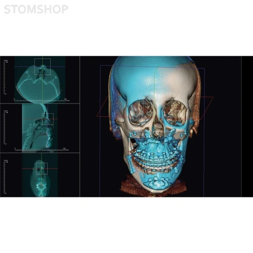 OP 3D Vision - аппарат панорамный рентгеновский стоматологический с функцией томографии | KaVo (Германия)