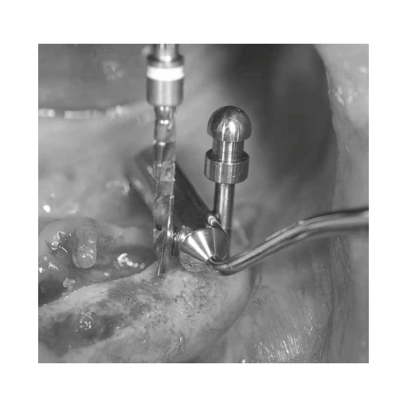 LM Implant Misura MR 3.3-5.6 - инструмент для позиционирования имплантатов | LM-Instruments Oy (Финляндия)