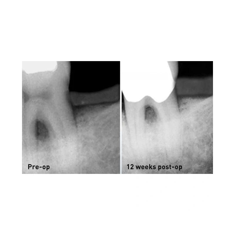 FONALaser - стоматологический диодный лазер | FONA Dental s.r.o. (Италия)
