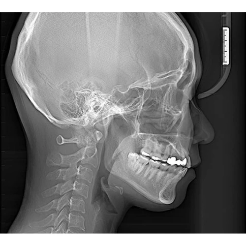 RAYSCAN Symphony Alpha SM3D – томограф 3 в 1: ортопантомограф и цефалостат 26х24 см, компьютерный томограф 3D 9х9 см | Ray Co., Ltd. (Ю. Корея)