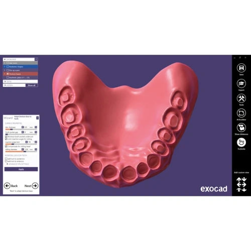 Exocad Full Denture Module - модуль для создания полносъемных протезов | Exocad (Германия)
