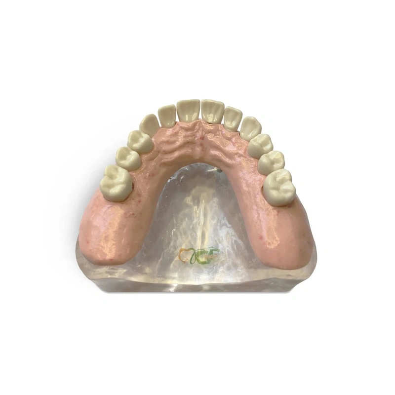 T12 – демонстрационная модель верхней челюсти с имплантами | GF Dental (Италия)