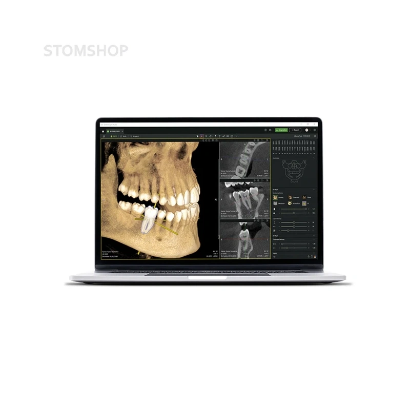 Seethrough Max - дентальный томограф | W&H DentalWerk (Австрия)