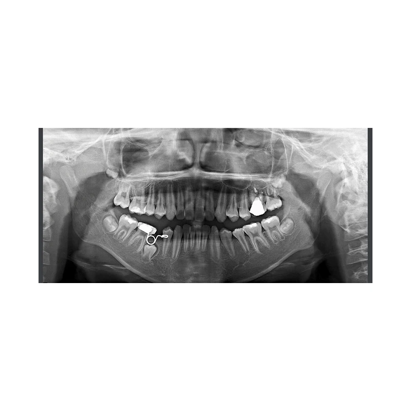 RAYSCAN Symphony Alpha SM3D – томограф 3 в 1: ортопантомограф и цефалостат 26х24 см, компьютерный томограф 3D 9х9 см | Ray Co., Ltd. (Ю. Корея)