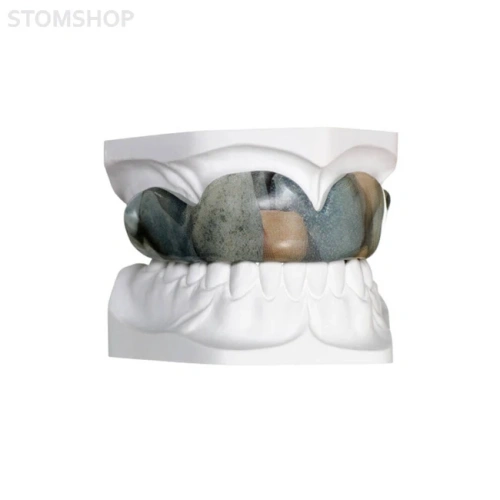 BIOPLAST Xtreme Deco – термоформовочные пластины, цветные, диаметр 125 мм, толщина 5 мм, 5 шт. | Scheu-Dental (Германия)