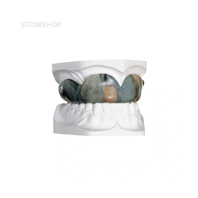 BIOPLAST Xtreme Deco – термоформовочные пластины, цветные, диаметр 125 мм, толщина 5 мм, 5 шт. | Scheu-Dental (Германия)