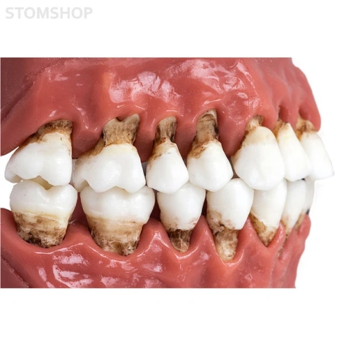Модель верхней и нижней челюсти с различными патологиями | Dentalstore (Италия)
