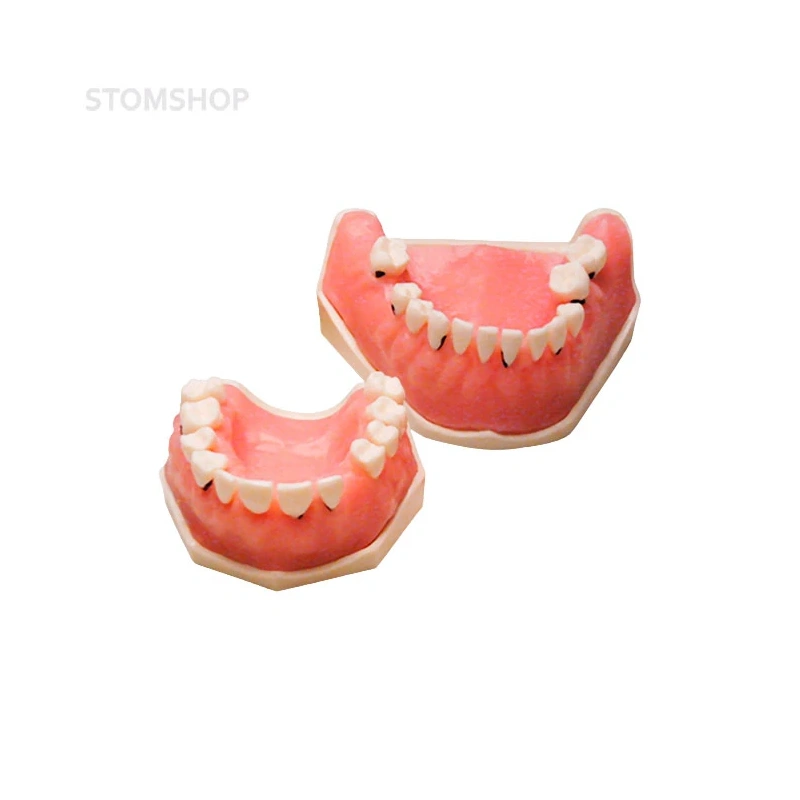 E05 – модель верхней и нижней челюсти для пародонтологической практики | GF Dental (Италия)