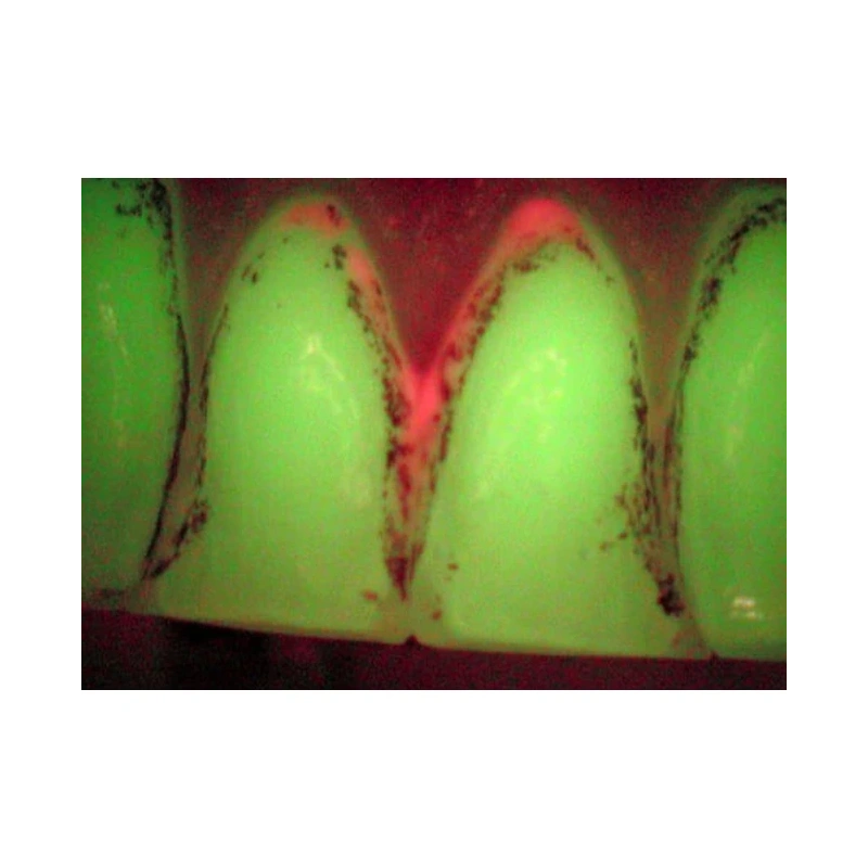 VistaCam IX - интраоральная видеокамера, подключается к USB ПК, с насадками Cam, Proof | D?rr Dental (Германия)