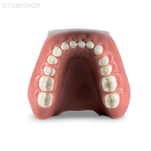 Модель верхней и нижней челюсти для отработки навыков закрытия рецессии | Dentalstore (Италия)