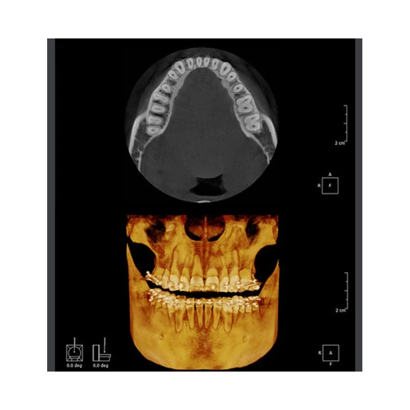 RAYSCAN Symphony Alpha SM3D – томограф 3 в 1: ортопантомограф и цефалостат 26х24 см, компьютерный томограф 3D 9х9 см | Ray Co., Ltd. (Ю. Корея)
