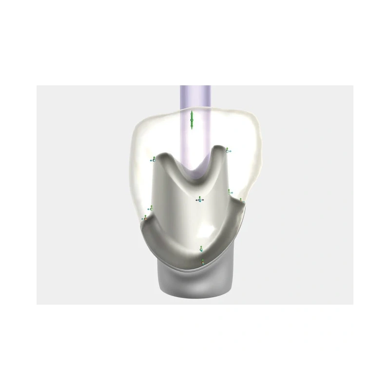 Exocad Implant Module - модуль для создания имплантов | Exocad (Германия)