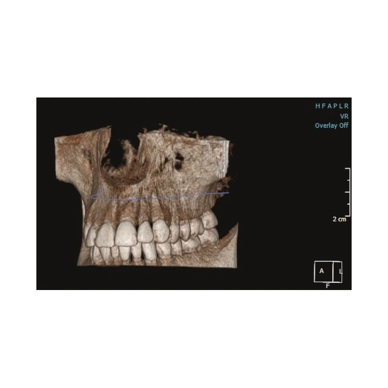 KaVo Pan eXam Plus 3D - цифровая панорамная рентгенодиагностическая система с функцией 3D-томографии 6x8 см и возможностью дооснащения модулем цефалостата | KaVo (Германия)