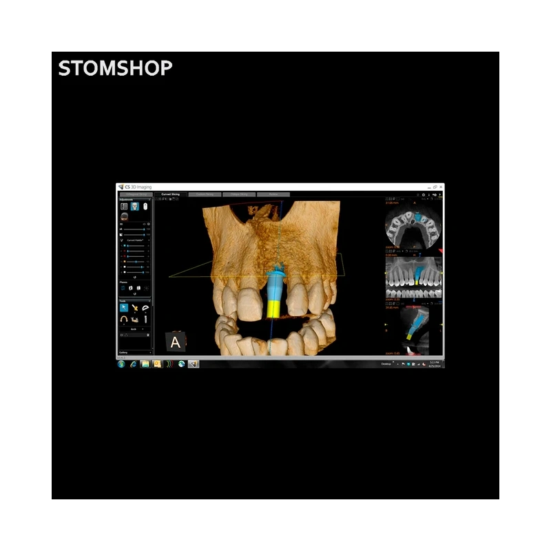 CS 8100 3D - дентальный трехмерный томограф, FOV 8х9 см | Carestream Dental (США)