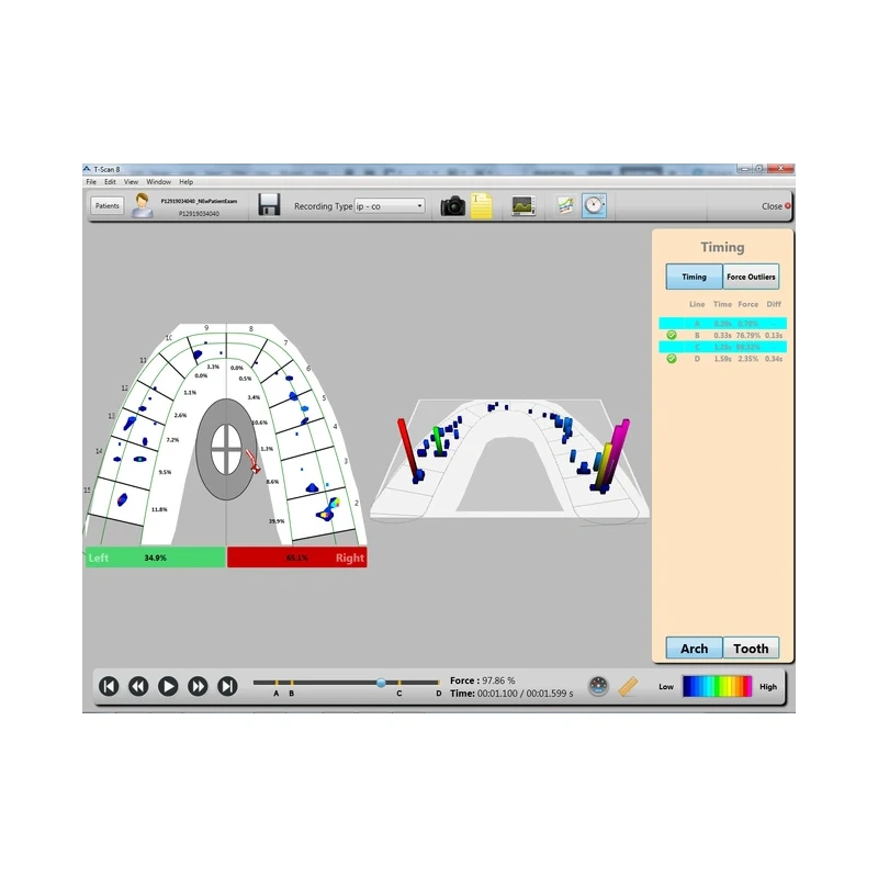 T-Scan Core - аппарат для цифрового анализа окклюзии | Tekscan (США)