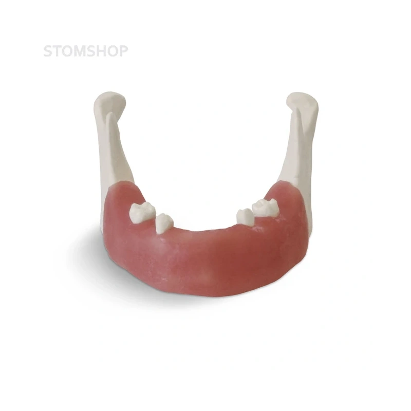 E82 – модель нижней челюсти для практики установки имплантатов | GF Dental (Италия)
