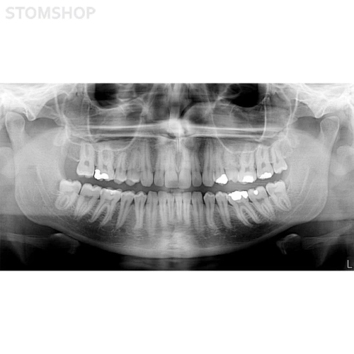 I-Max Touch Pano - цифровой панорамный рентгеновский аппарат | Owandy (Франция)