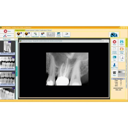 FONA CDR powered by SCHICK - система компьютерной стоматологической радиографии | FONA Dental s.r.o. (Италия)