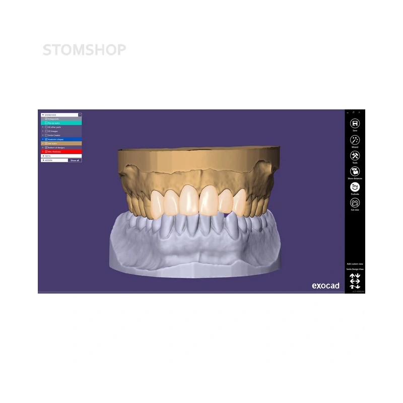 Exocad Smile Creator - модуль для планирования улыбки | Exocad (Германия)