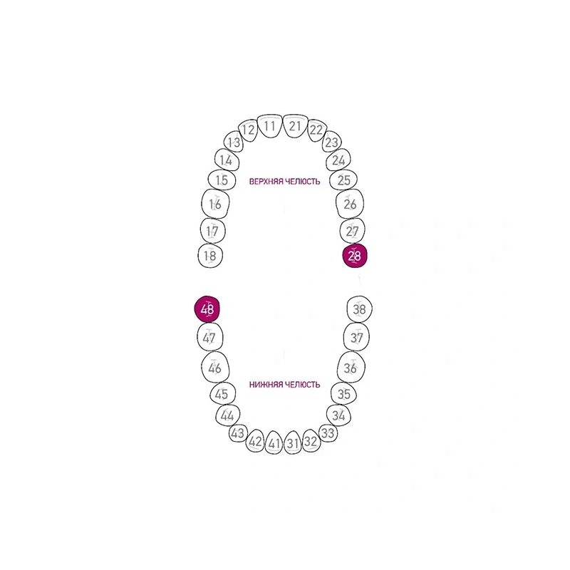 Кламмер для раббердама №12A Black с черным оксидным покрытием | Dentech Corporation (Япония)