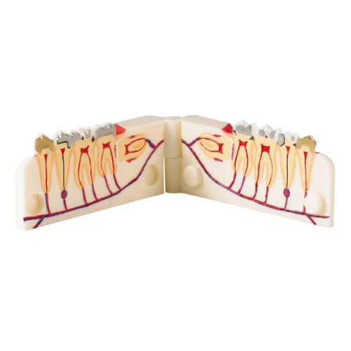 TOOTH MODEL V-TYPE - демонстрационная модель с сагиттальным разрезом | Hanil (Ю. Корея)