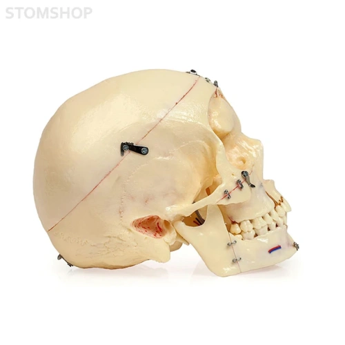 Демонстрационная модель черепа, состоящая из 10 частей | Dentalstore (Италия)