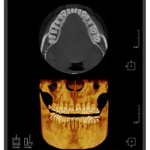 RAYSCAN Symphony Alpha M3DS – томограф 3 в 1: ортопантомограф и цефалостат (OneShot) 30х25 см, компьютерный томограф 3D 9х9 см | Ray Co., Ltd. (Ю. Корея)