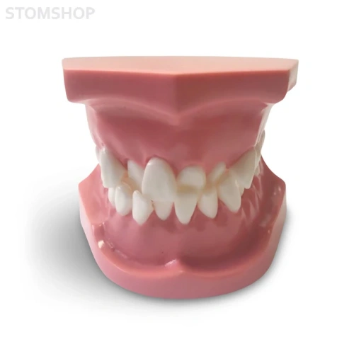 ORB02 – ортодонтическая модель с брекетами и твердой десной, 1 класс | GF Dental (Италия)