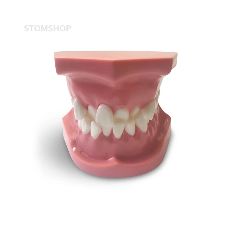 ORB02 – ортодонтическая модель с брекетами и твердой десной, 1 класс | GF Dental (Италия)