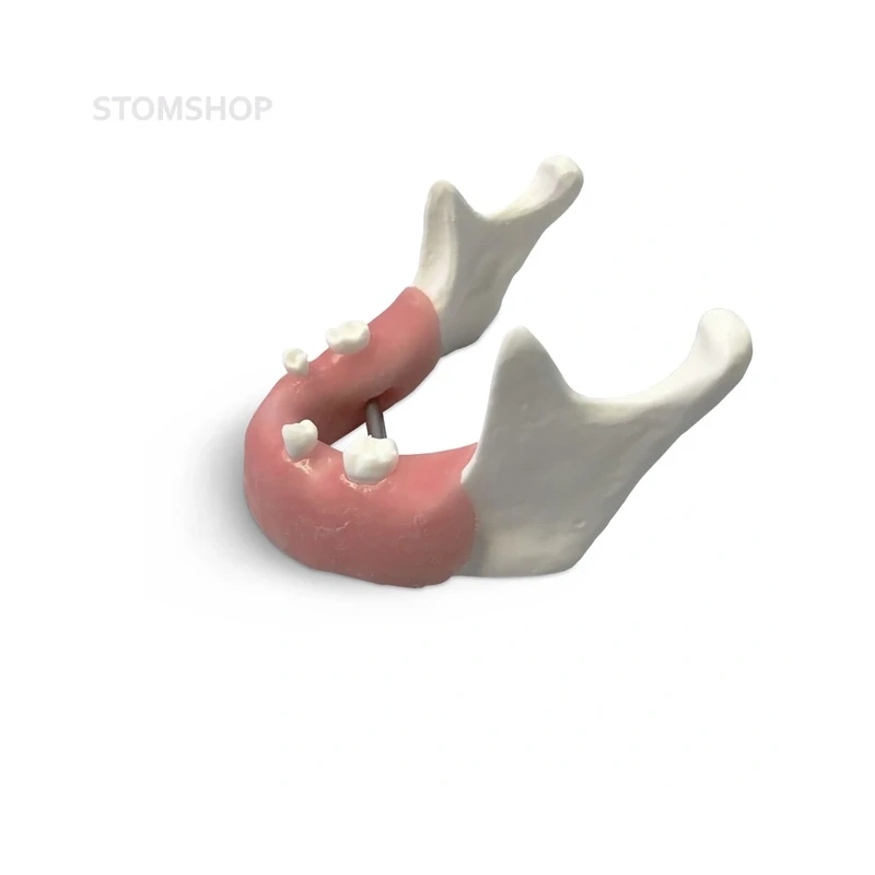 E82 – модель нижней челюсти для практики установки имплантатов | GF Dental (Италия)