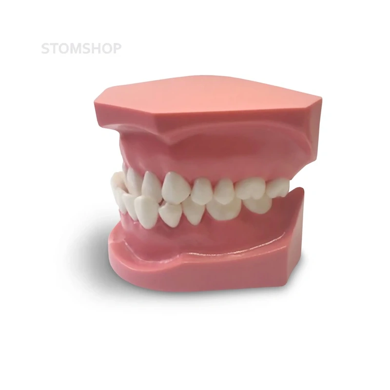 ORB04 – ортодонтическая модель с брекетами и твердой десной | GF Dental (Италия)