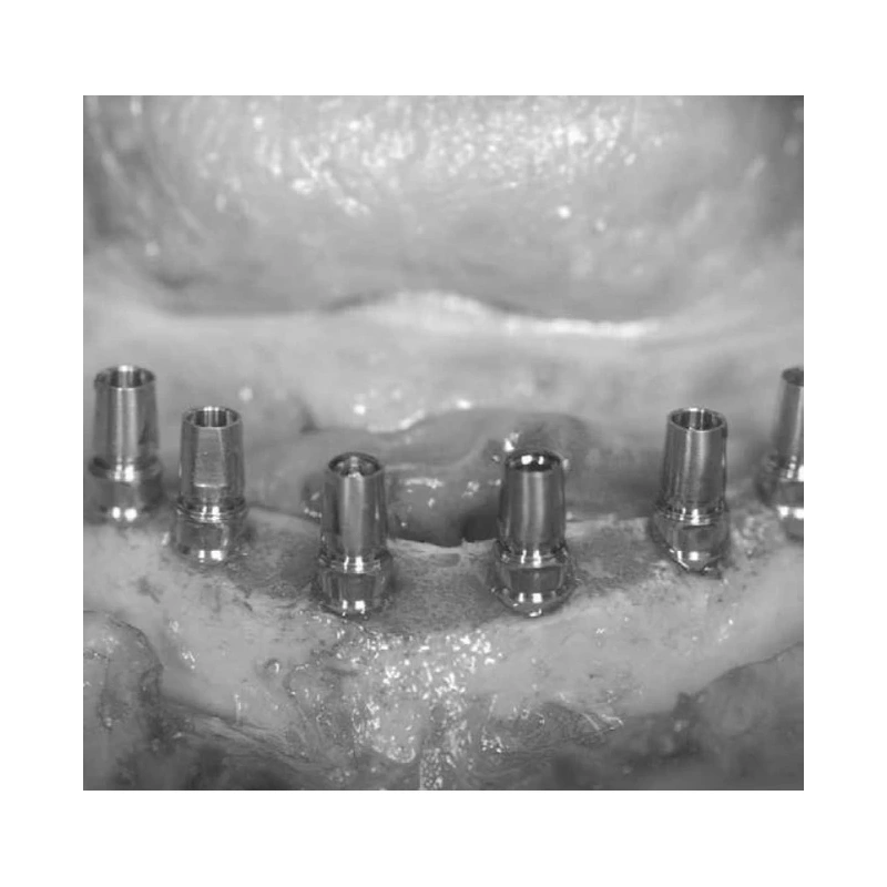 LM Implant Misura MR 3.7-6.3 - инструмент для позиционирования имплантатов | LM-Instruments Oy (Финляндия)