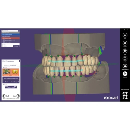 Exocad Full Denture Module - модуль для создания полносъемных протезов | Exocad (Германия)