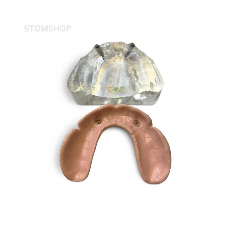 T12 – демонстрационная модель верхней челюсти с имплантами | GF Dental (Италия)