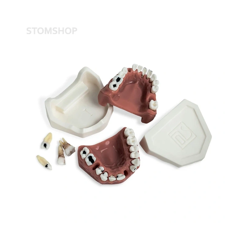 Модель верхней и нижней челюсти с различными патологиями | Dentalstore (Италия)