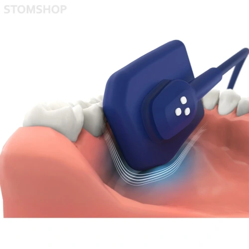 EzSensor Soft 1.5 - цифровой радиовизиограф, размер 1.5 | Vatech (Ю. Корея)