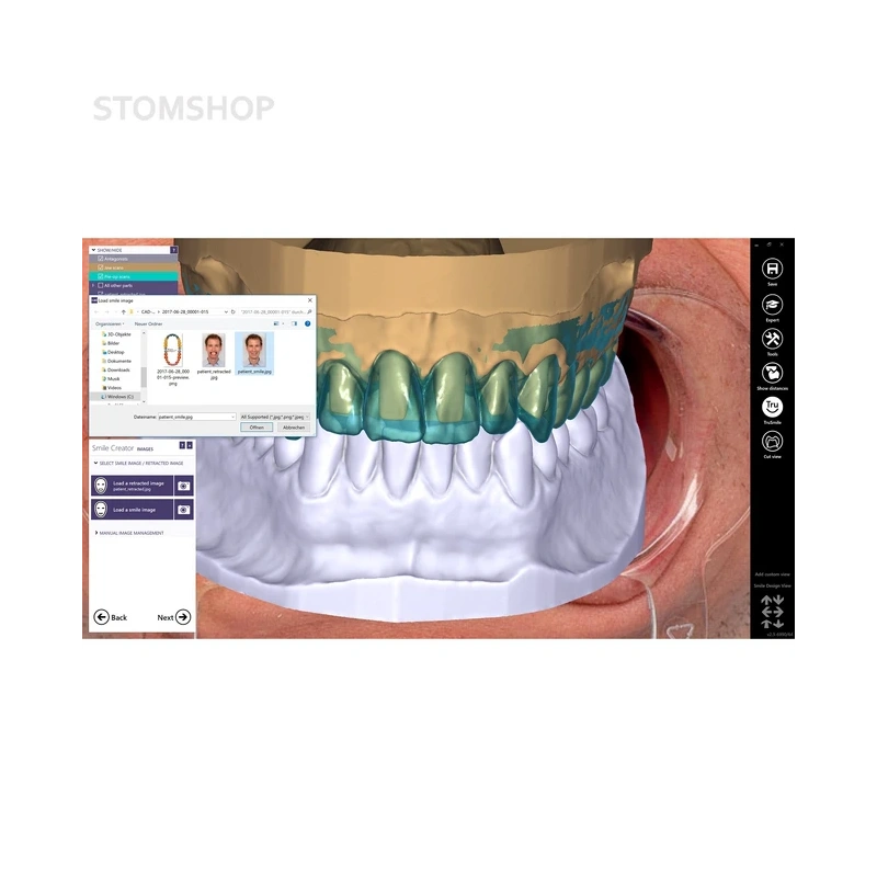 Exocad Smile Creator - модуль для планирования улыбки | Exocad (Германия)
