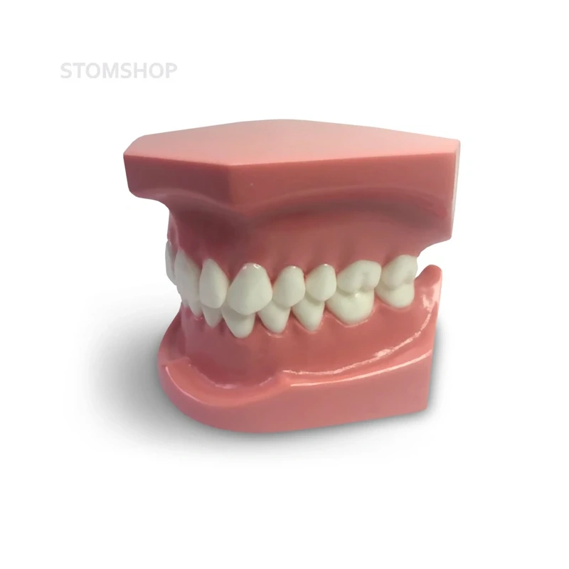 ORB01 – ортодонтическая модель с брекетами и твердой десной, 1 класс | GF Dental (Италия)