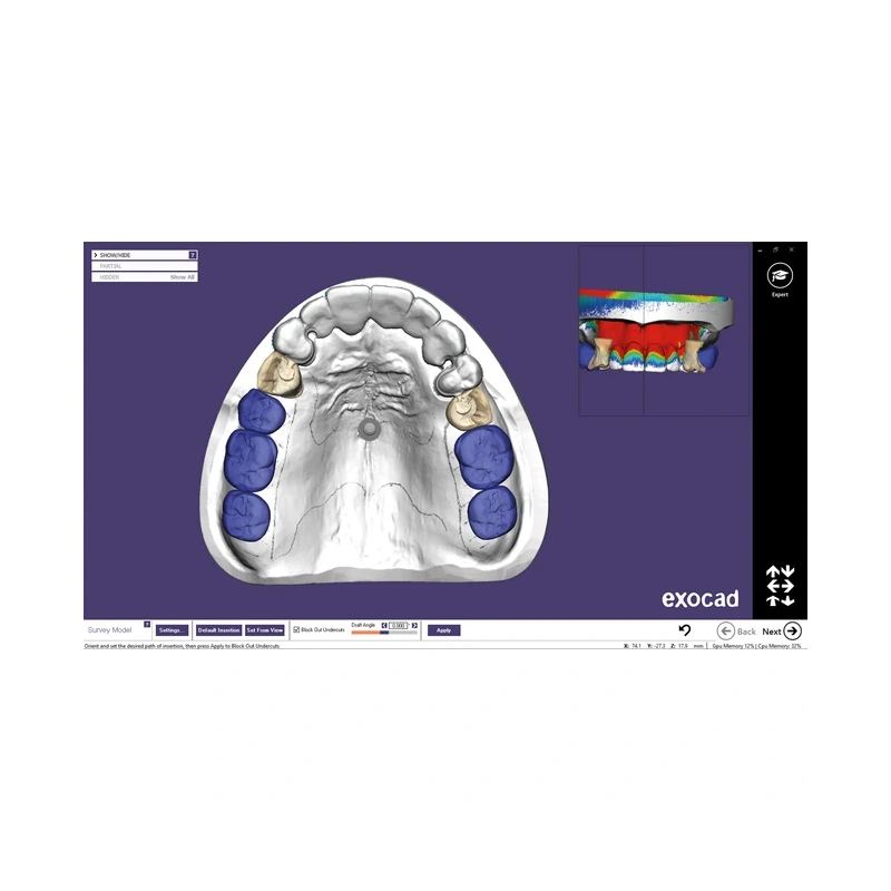 Exocad Partial Framework Module - модуль для создания бюгелей | Exocad (Германия)
